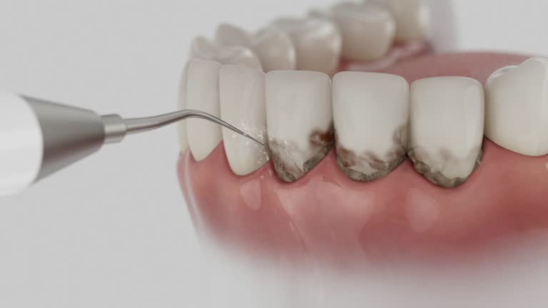 Reliable Dental Implants contractor in Springfield, VA by Smile Center Dentistry